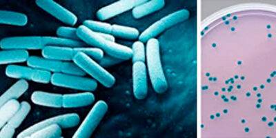 Chronobacter sakazakii en preparados en polvo para lactantes