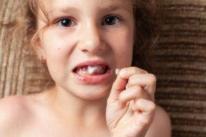 Qué hacer ante un traumatismo dental: Salvando tu diente tras un golpe