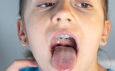 ¿Qué hacer ante un traumatismo dental?